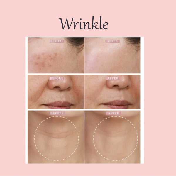 Thanh bôi ngăn ngừa nếp nhăn Elujai Collagen Wrinkle Balm 10g