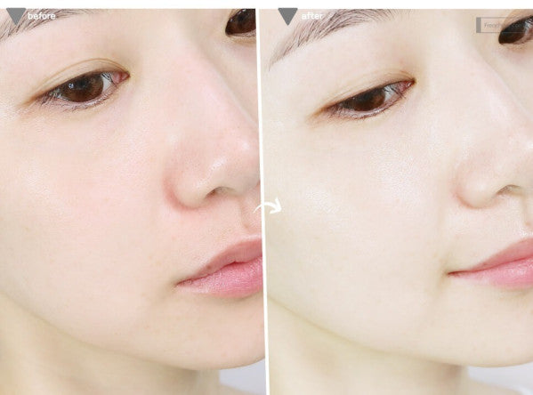 Sample kem cho da lão hóa và nám Hera Signia Cream 48 gói