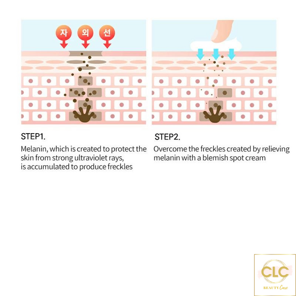 Set Hút Nám CELLBN - Blemish Spot Cream & Black Spot Patch Set