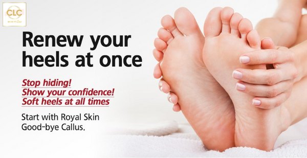Dụng cụ tẩy tế bào chết cho chân Royal Skin Goodbye Callus (Pack of 1)