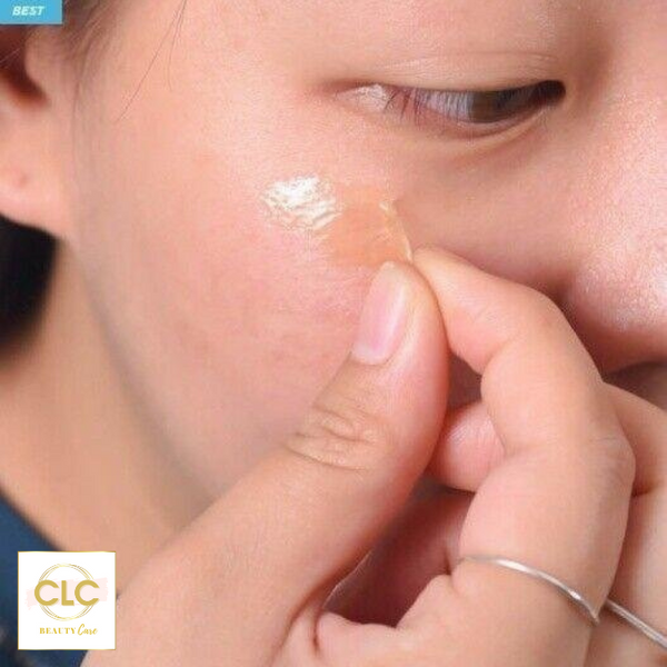 Set Hút Nám CELLBN - Blemish Spot Cream & Black Spot Patch Set
