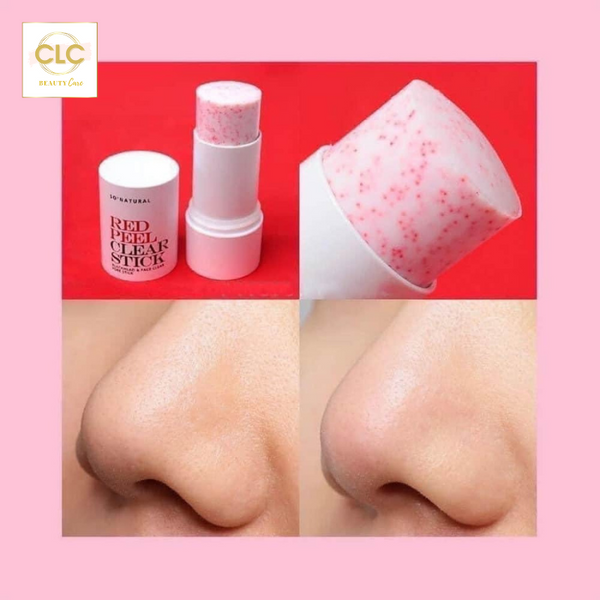 Thanh Lăn Trị Mụn Đầu Đen Hàn Quốc So'Natural Red Peel Clear Stick Blackhead & Face Clear Pore Stick 23g