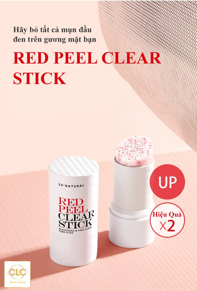Thanh Lăn Trị Mụn Đầu Đen Hàn Quốc So'Natural Red Peel Clear Stick Blackhead & Face Clear Pore Stick 23g