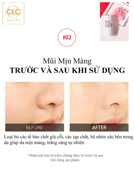 Thanh Lăn Trị Mụn Đầu Đen Hàn Quốc So'Natural Red Peel Clear Stick Blackhead & Face Clear Pore Stick 23g