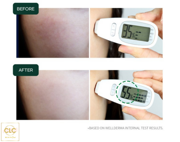 Bộ sản phẩm Wellderma Treatment Repair Ampoule Serum Cica gồm: Serum Cica và thanh lăn Roller