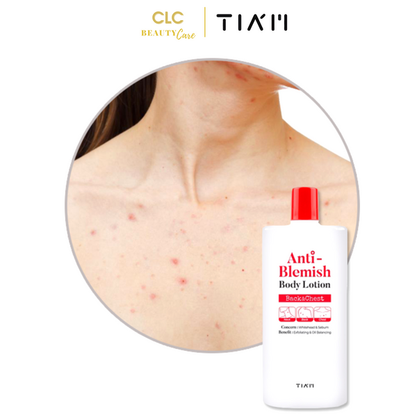 Sữa dưỡng thể chăm sóc da mụn, dưỡng trắng Tiam Anti-Blemish Body Lotion (Ngực và Lưng) 200ml